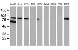 CTNNB1 / Beta Catenin Antibody (clone OTI6A3)