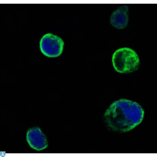 MUSK Antibody