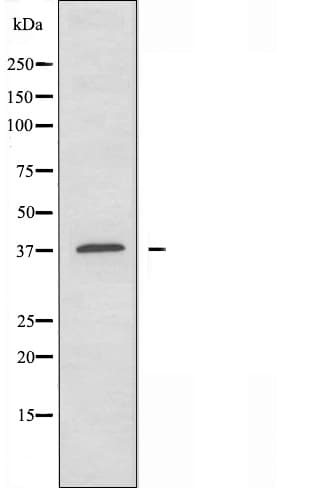 AHSA1 / AHA1 Antibody