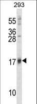 IHC-plus™ ISG15 Antibody (aa31-61)