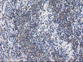 RTN4IP1 / NIMP Antibody (clone OTI3B2)
