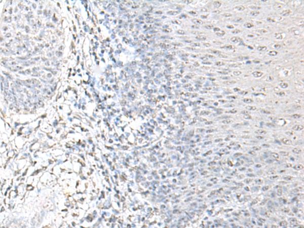 EPM2A / Laforin Antibody