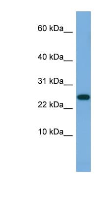 Polyclonal Rabbit anti-Human ANKRD39 Antibody (aa35-84, WB)