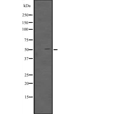 Polyclonal Rabbit anti-Human TFAP2D Antibody (WB)