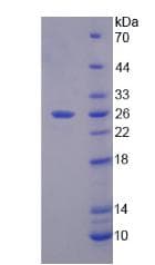 Bovine Alpha-Fetoprotein (Recombinant His)