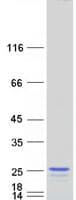 Human TP53I11 / PIG11 Protein (Recombinant Myc-DDK (Flag))