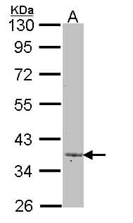 TGFB4 / LEFTY2 Antibody (aa25-366)