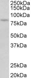 IHC-plus™ Polyclonal Goat anti-Human PRKCB / PKC-Beta Antibody (aa631-642, IHC, WB)