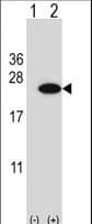 CIRP / CIRBP Antibody (aa145-172)