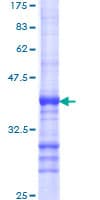Human FZD6 / Frizzled 6 Protein (Recombinant GST, N-terminus)