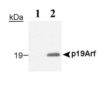p19ARF (Mouse Cdkn2a) Antibody (aa54-75, clone 12A11)