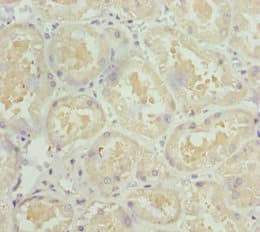 NDUFS1 Antibody