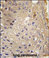ATG9A Antibody (aa 723-753)
