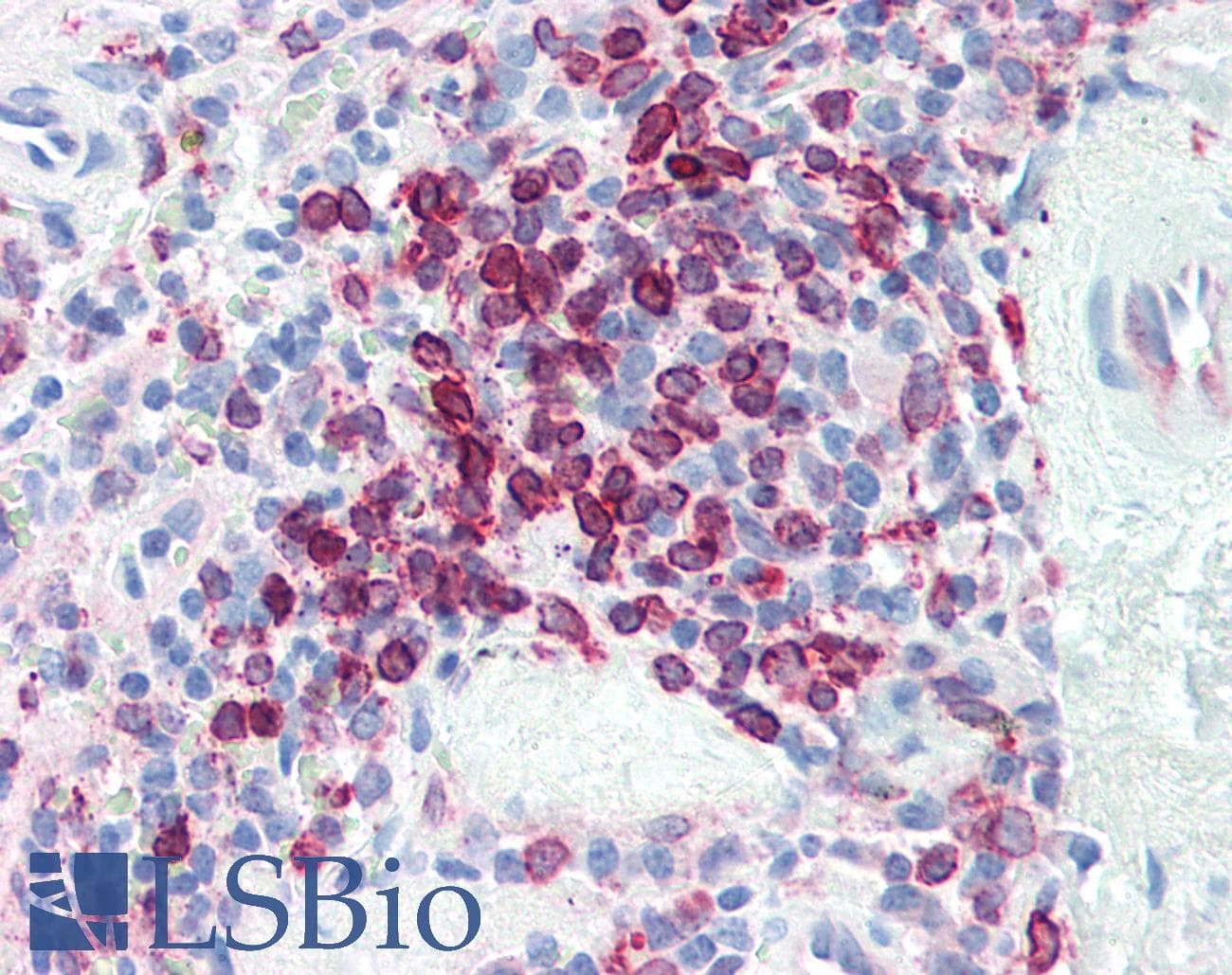 PathPlus™ Monoclonal Mouse anti-Human CD74 / CLIP Antibody (IHC)