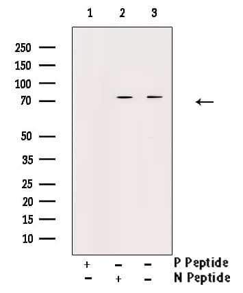 Polyclonal Rabbit anti-Human RAF1 / RAF Antibody (phospho-Ser296, IHC, IF, WB)