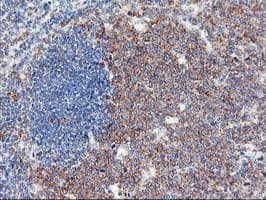 Monoclonal Mouse anti-Human USP10 Antibody (clone OTI1A10, IHC, WB)