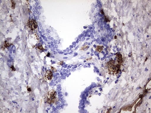 Monoclonal Mouse anti-Human S100A9 / MRP14 Antibody (clone OTI10D5, IHC, WB)