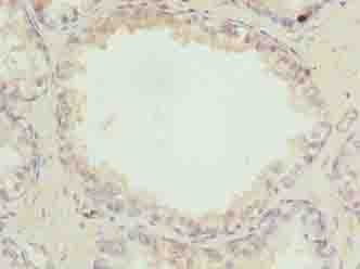 ACSBG1 / hsBG Antibody