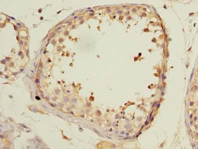 KCTD4 Antibody