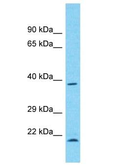 Polyclonal Rabbit anti-Human WDR21A / DCAF4 Antibody (aa271-320, WB)