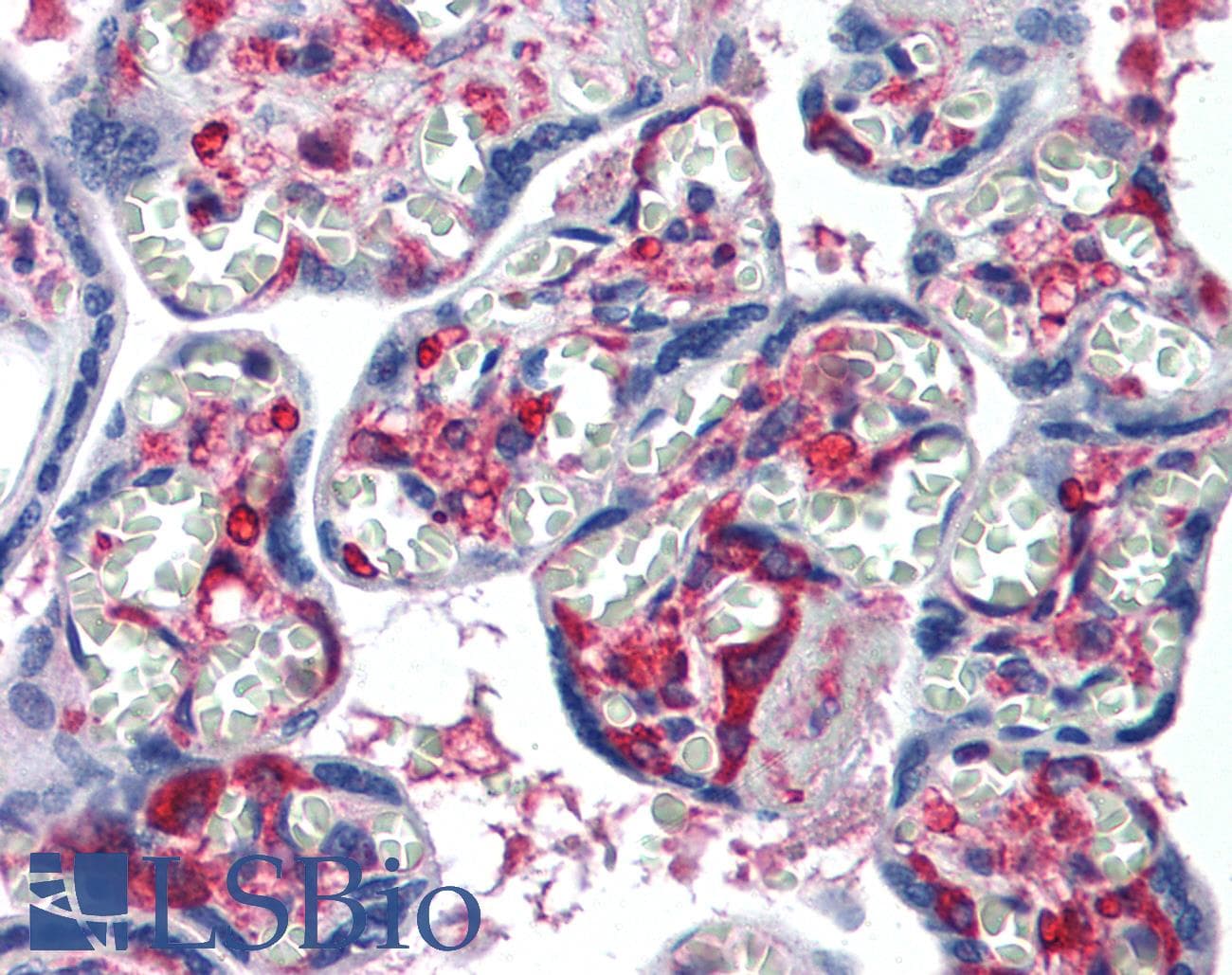 IHC-plus™ NME1 / NM23 Antibody (clone 1D7)