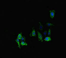 Polyclonal Rabbit anti-Human PPP2R2D Antibody (IHC, IF, WB)