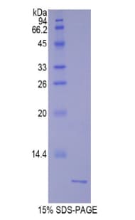 Rat UCN2 / SRP Protein (Recombinant His)