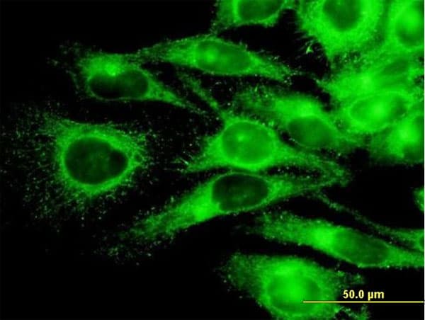 Monoclonal Mouse anti-Human PRKAR2A Antibody (clone 6A9, IHC, IF, WB)
