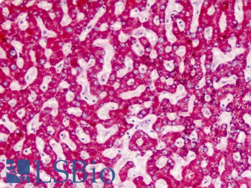 IHC-plus™ AGXT / SPT Antibody (aa96-125)