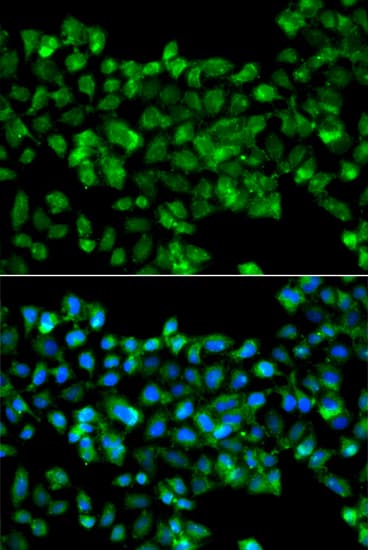 Polyclonal Rabbit anti-Human CBR3 Antibody (IHC, IF, WB)