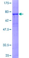 Human PRKAR2A Protein (Recombinant GST)