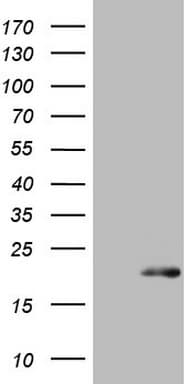 S100A9 / MRP14 Antibody (clone OTI13E12)