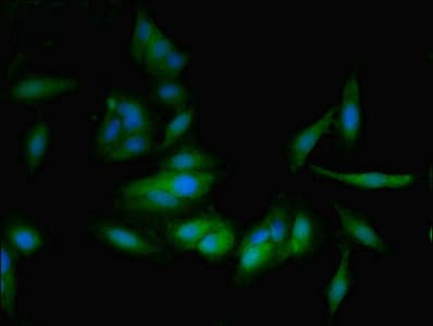 Polyclonal Rabbit anti-Human Prostaglandin D Synthase Antibody (aa23-190)