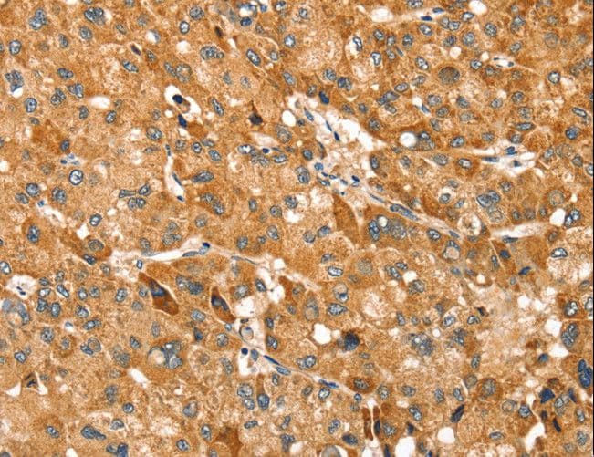 TRIM62 Antibody
