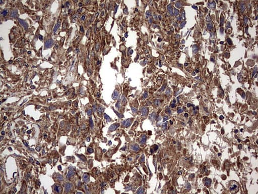 IL1RN Antibody (clone OTI2B1)