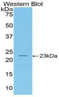 IL-1B / IL-1 Beta Antibody (aa115-266)