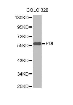 PDI / P4HB Antibody