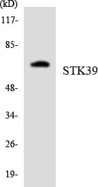 STK39 / SPAK Antibody (aa271-320)