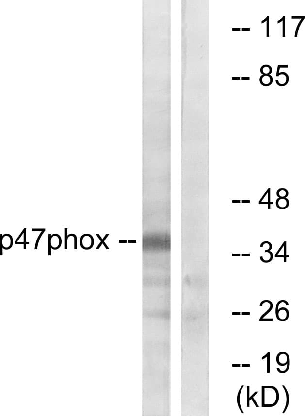 Polyclonal Rabbit anti-Human NCF1 / p47phox / p47 phox Antibody (aa331-380, IHC, WB)