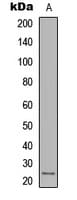 IHC-plus™ Polyclonal Rabbit anti-Human IL12A / p35 Antibody (Internal, IHC, WB)
