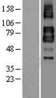 TGFBR2 Protein (Over-Expression Lysate Myc-DDK (Flag))