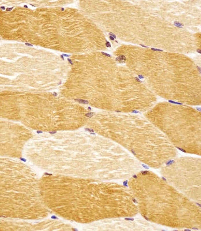 Polyclonal Rabbit anti-Human SLC29A2 / ENT2 Antibody (N-Terminus, IHC, WB)