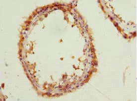PCM1 Antibody