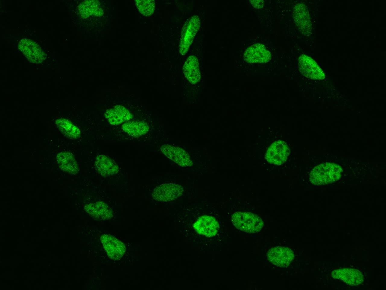 Polyclonal Rabbit anti-Human RFC4 Antibody (IHC, IF, WB)