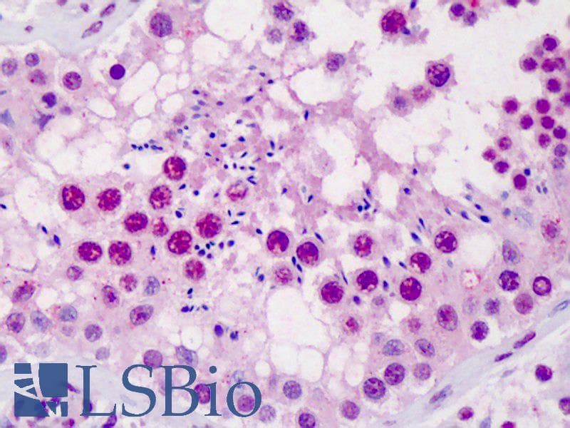 IHC-plus™ SCML1 Antibody (clone 4G3)