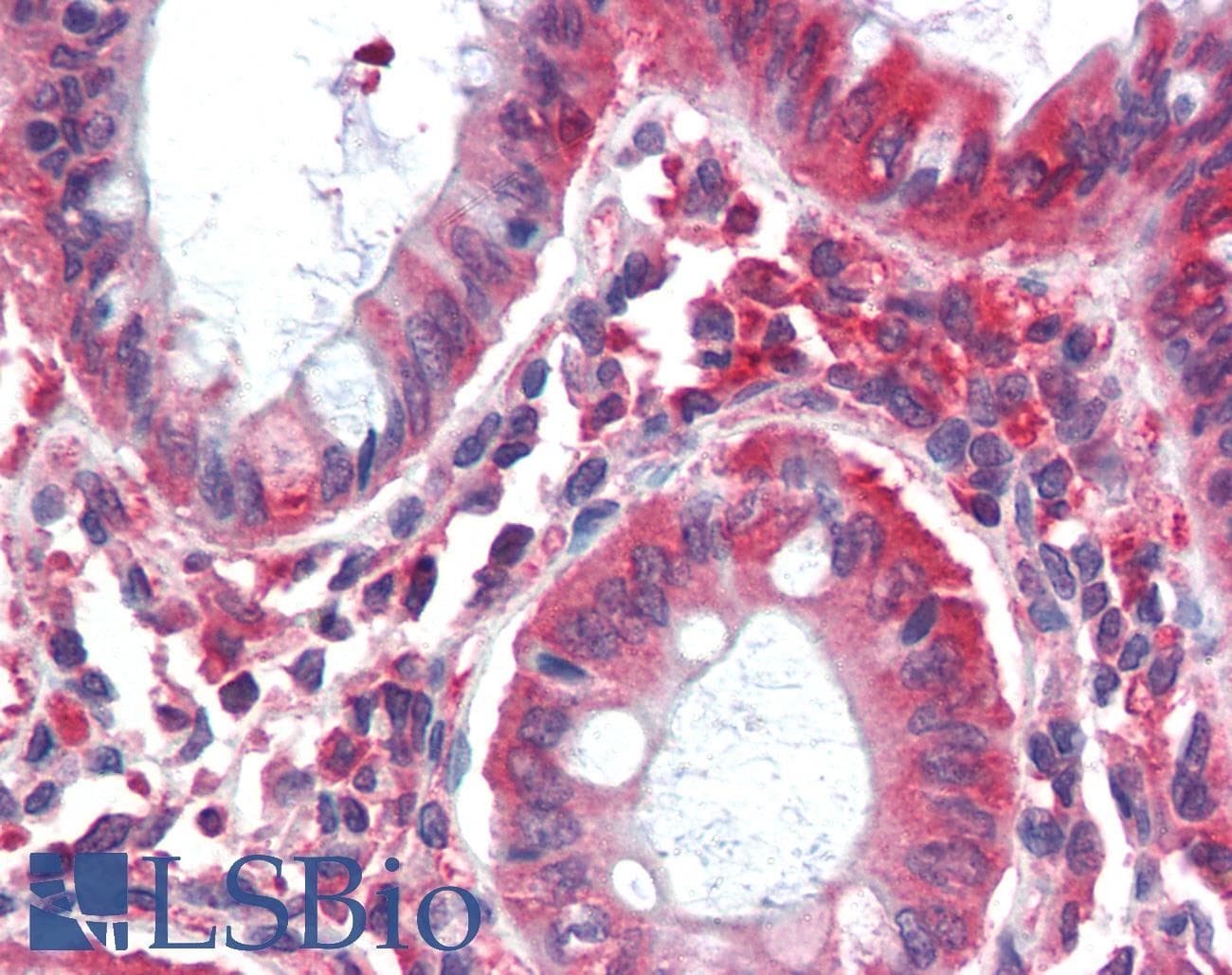 IHC-plus™ Polyclonal Rabbit anti-Human MYO5B / Myosin VB Antibody (C-Terminus, IHC, WB)
