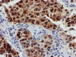 FBXO21 Antibody (clone OTI5H4)