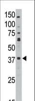 Polyclonal Rabbit anti-Human MAGE10 / MAGEA10 Antibody (aa324-353, IHC, WB)