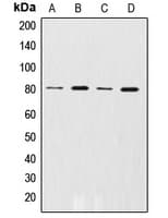 ADRBK1 / GRK2 Antibody (phospho-Ser29)