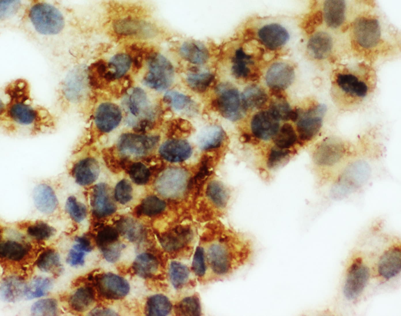 SERPINA6 / CBG Antibody (aa102-120)